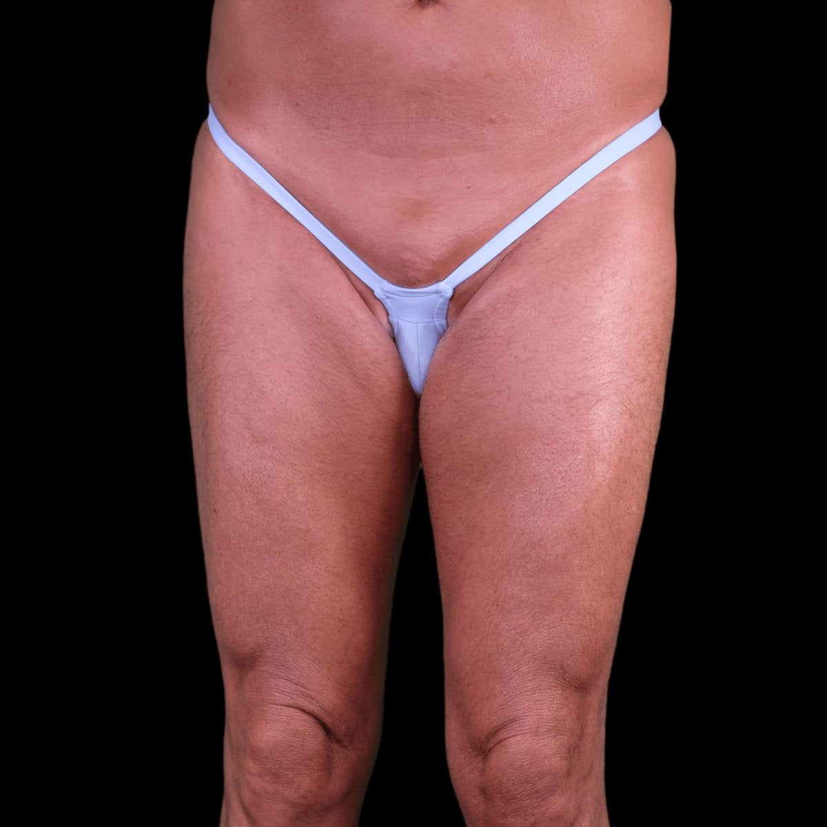 koala145h No Gender Suits-Let 水着 Koala